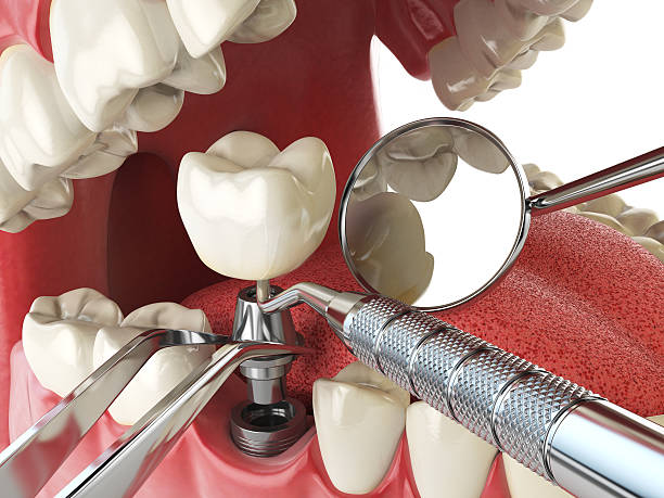 Best Tooth Infection Emergency Dentist  in Cavalier, ND